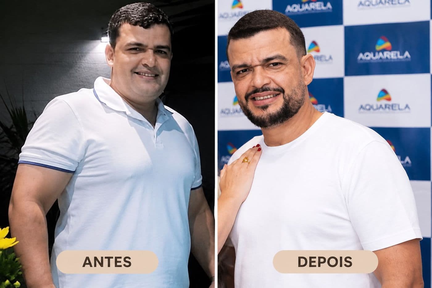 Evolução de paciente acompanhado pelo Dr. Paullineli: antes e depois